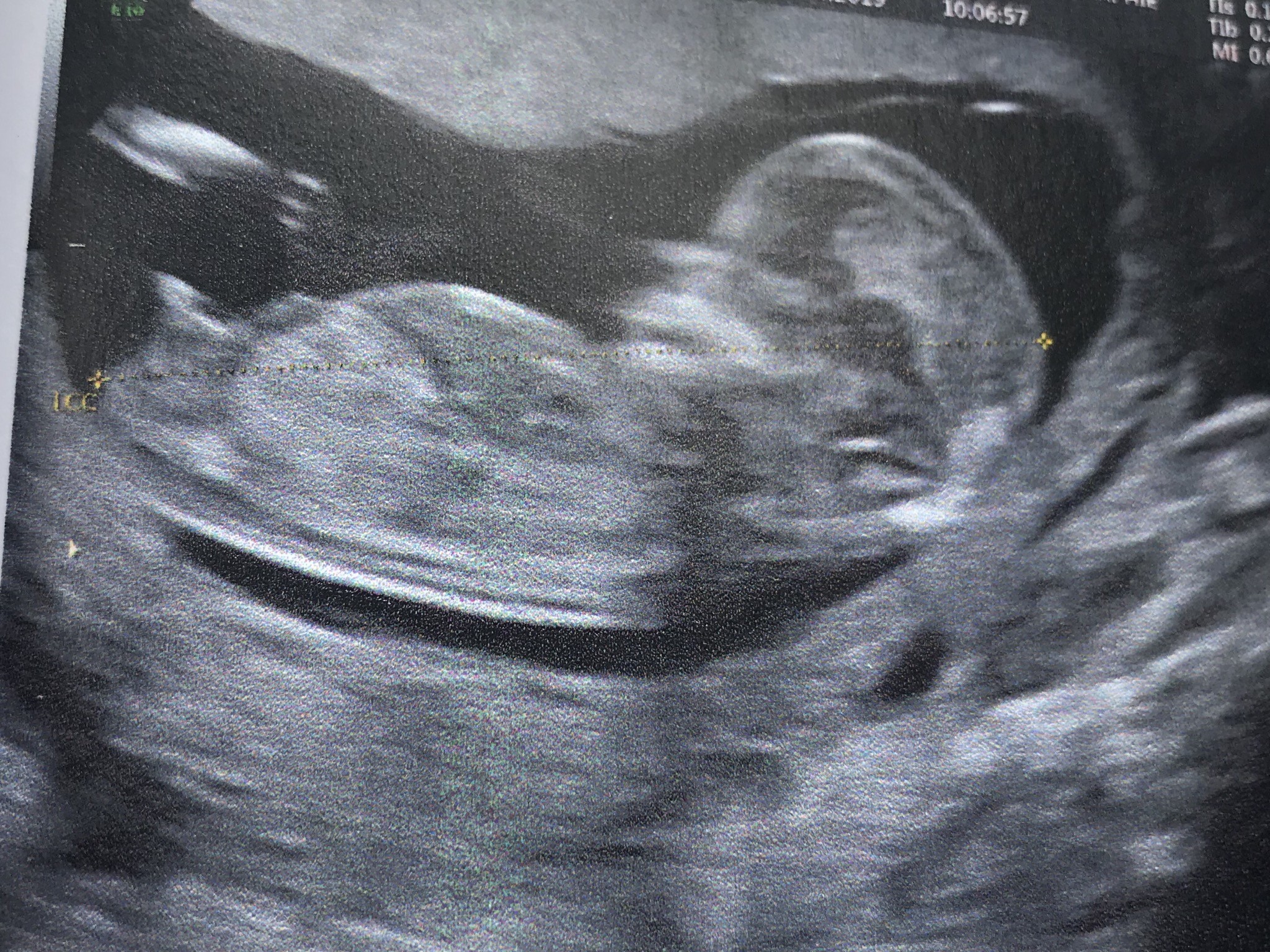 Sexe Bebe 13sa 3 Aidez Moi Echographie Connaitre Le Sexe De Votre Bebe Forum Grossesse Amp Bebe Doctissimo Sexe Bebe 13sa 3 Aidez Moi Echographie Connaitre Le Sexe De Votre Bebe Forum Grossesse Amp Bebe Doctissimo