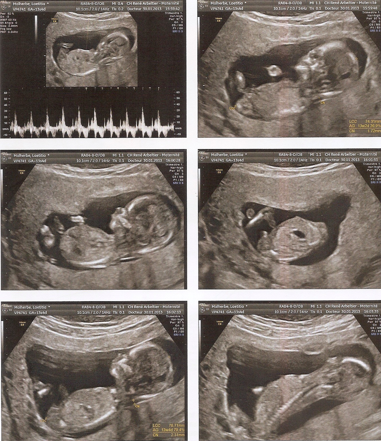 Echographie 13 Sa 4 Jrs Determination Du Sexe Echographie Connaitre Le Sexe De Votre Bebe Forum Grossesse Amp Bebe Doctissimo Echographie 13 Sa 4 Jrs Determination Du Sexe Echographie Connaitre Le Sexe De Votre Bebe Forum Grossesse Amp Bebe Doctissimo