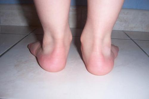 Podologue Sante De L Enfant Forum Sante Doctissimo Podologue Sante De L Enfant Forum Sante Doctissimo