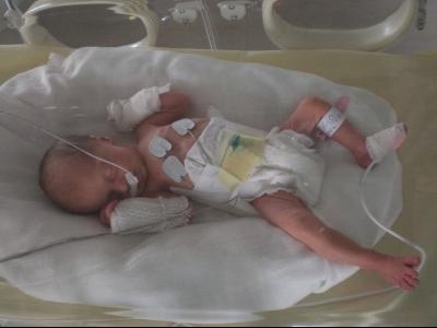 Les Prema De 07 C Est Ici Prematures Forum Grossesse Amp Bebe Doctissimo Les Prema De 07 C Est Ici Prematures Forum Grossesse Amp Bebe Doctissimo