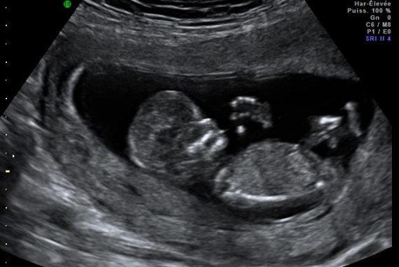 Echo 12sa 1 Petit Prince Ou Petite Princesse Reponse Vendredi Avril Echo 12sa 1 Petit Prince Ou Petite Princesse Reponse Vendredi Avril