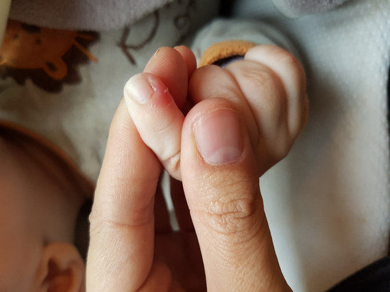 Doigt Bebe Rouge Les Ramadanettes Forum Grossesse Amp Bebe Doctissimo