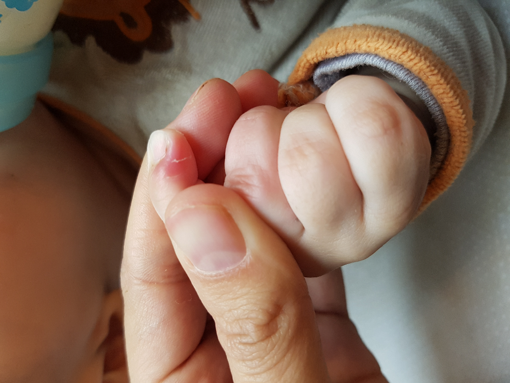 Doigt Bebe Rouge Les Ramadanettes Forum Grossesse Amp Bebe Doctissimo Doigt Bebe Rouge Les Ramadanettes Forum Grossesse Amp Bebe Doctissimo