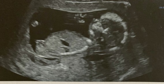 Echo 14 Sa 4 Fille Ou Garcons Echo 14 Sa 4 Fille Ou Garcons