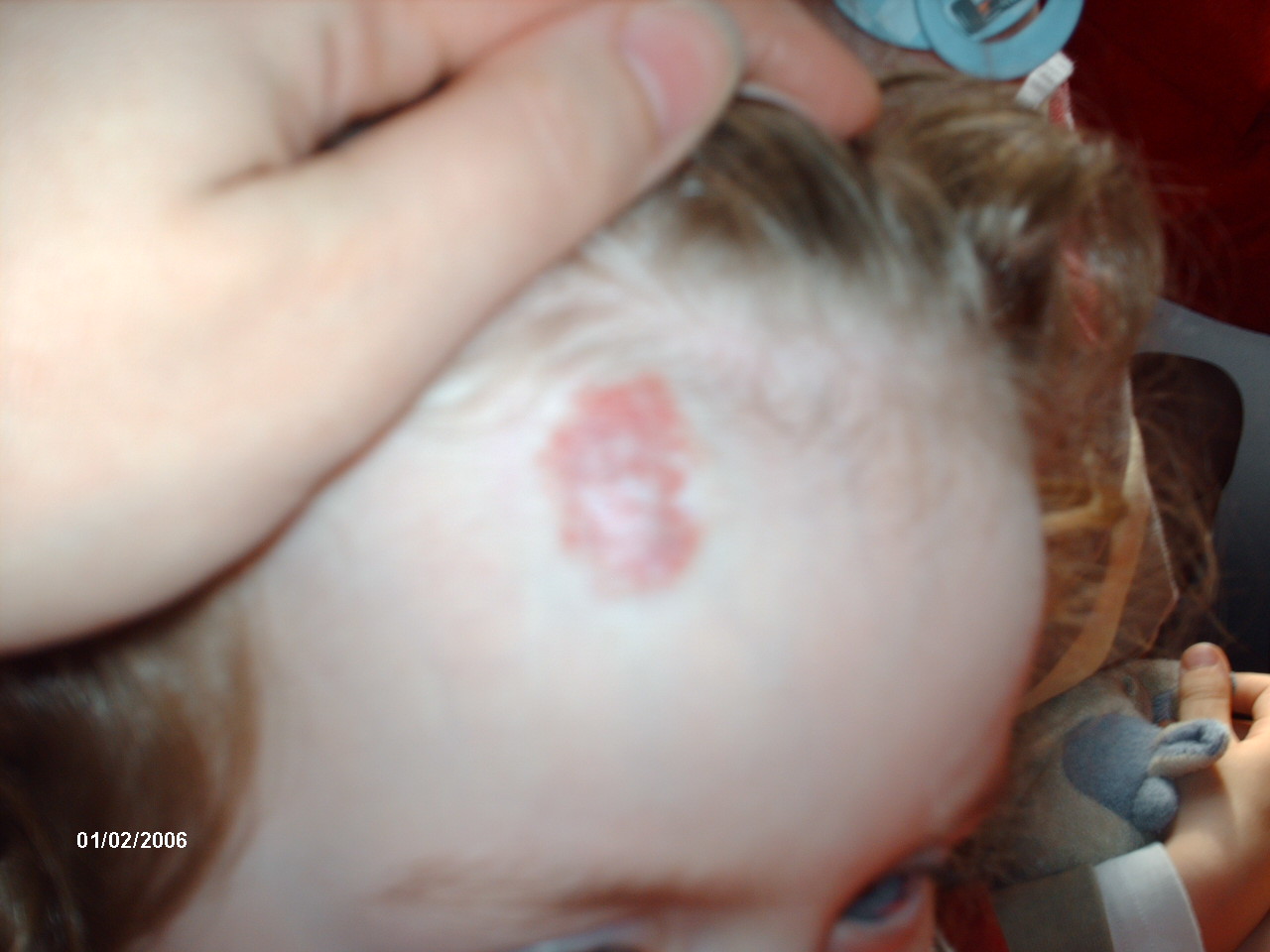 Question Taches De Naissance Mamans Et Futures Mamans De Belgique Forum Grossesse Amp Bebe Doctissimo Question Taches De Naissance Mamans Et Futures Mamans De Belgique Forum Grossesse Amp Bebe Doctissimo