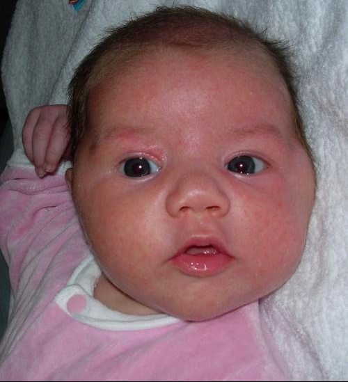 Mon Bebe A Des Petits Boutons Bebe Grandit Forum Grossesse Amp Bebe Doctissimo Mon Bebe A Des Petits Boutons Bebe Grandit Forum Grossesse Amp Bebe Doctissimo