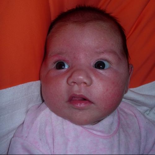 Mon Bebe A Des Petits Boutons Bebe Grandit Forum Grossesse Amp Bebe Doctissimo Mon Bebe A Des Petits Boutons Bebe Grandit Forum Grossesse Amp Bebe Doctissimo