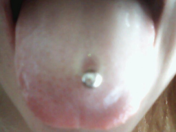 Piercing Langue Infect Doctissimo