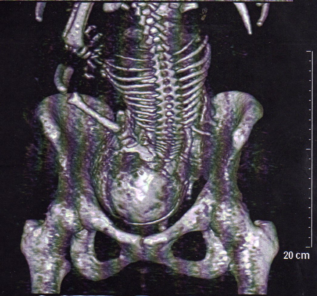 Ma Radio Du Bassin Futures Mamans Forum Grossesse Amp Bebe Doctissimo