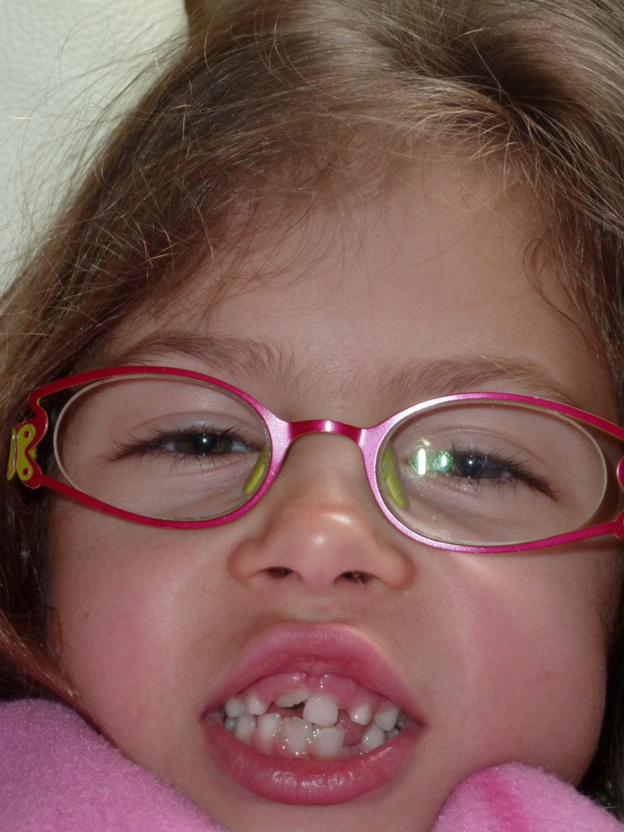 Dents Definitives Bebe Grandit Forum Grossesse Amp Bebe Doctissimo Dents Definitives Bebe Grandit Forum Grossesse Amp Bebe Doctissimo