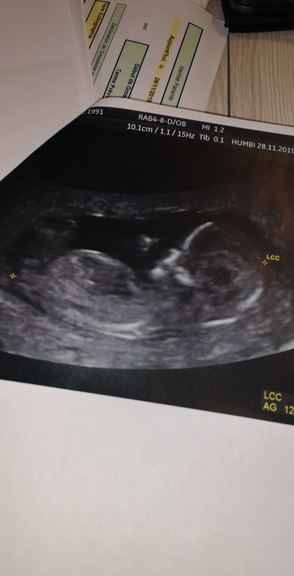 A Votre Avis Fille Ou Garcons Echo Des 12sa Echographie Connaitre Le Sexe De Votre Bebe Forum Grossesse Amp Bebe Doctissimo