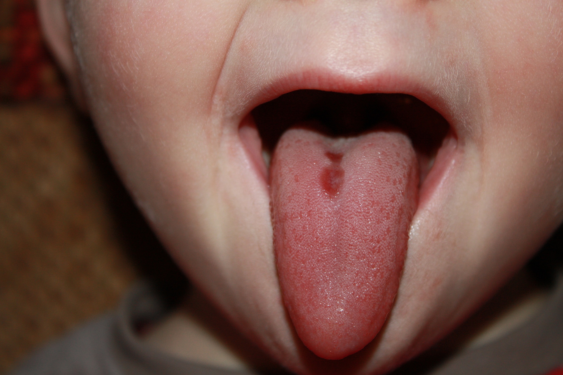 Besoin D Avis Voir Photo De Sa Langue News Plus Bas Mamans Et Futures Mamans Du Quebec Forum Grossesse Amp Bebe Doctissimo Besoin D Avis Voir Photo De Sa Langue News Plus Bas Mamans Et Futures Mamans Du Quebec Forum Grossesse Amp Bebe Doctissimo