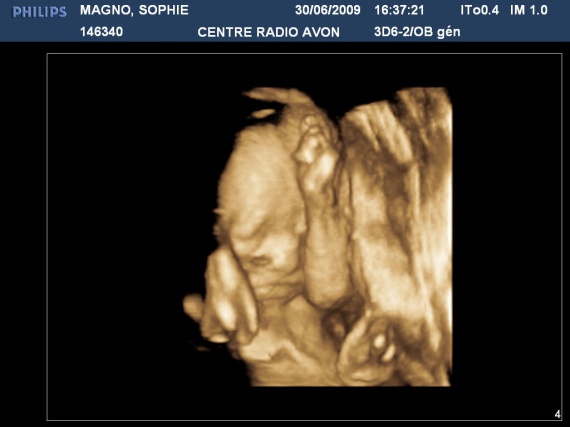Mon Echo En 4d M Obsede Mon Echo En 4d M Obsede