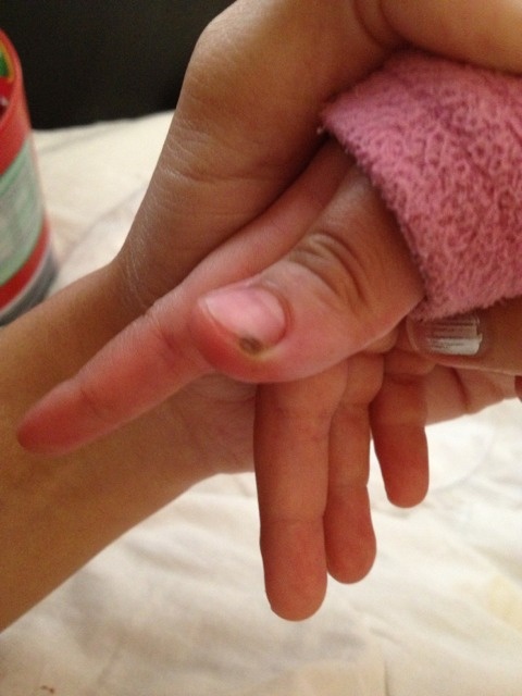 Panaris Les Ramadanettes Forum Grossesse Amp Bebe Doctissimo Panaris Les Ramadanettes Forum Grossesse Amp Bebe Doctissimo