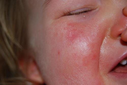 Le Visage De Ma Fille Me Fait Peine A Voir Regle Bebe Grandit Forum Grossesse Amp Bebe Doctissimo