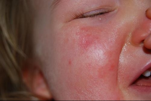 Le Visage De Ma Fille Me Fait Peine A Voir Regle Bebe Grandit Forum Grossesse Amp Bebe Doctissimo Le Visage De Ma Fille Me Fait Peine A Voir Regle Bebe Grandit Forum Grossesse Amp Bebe Doctissimo
