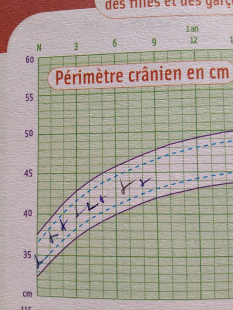 Bebe 8 Mois Casse Sa Courbe De Poid Allaitement Forum Grossesse Amp Bebe Doctissimo