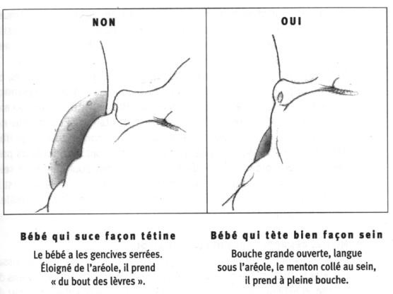 Help Crevasse Allaitement Forum Grossesse Amp Bebe Doctissimo