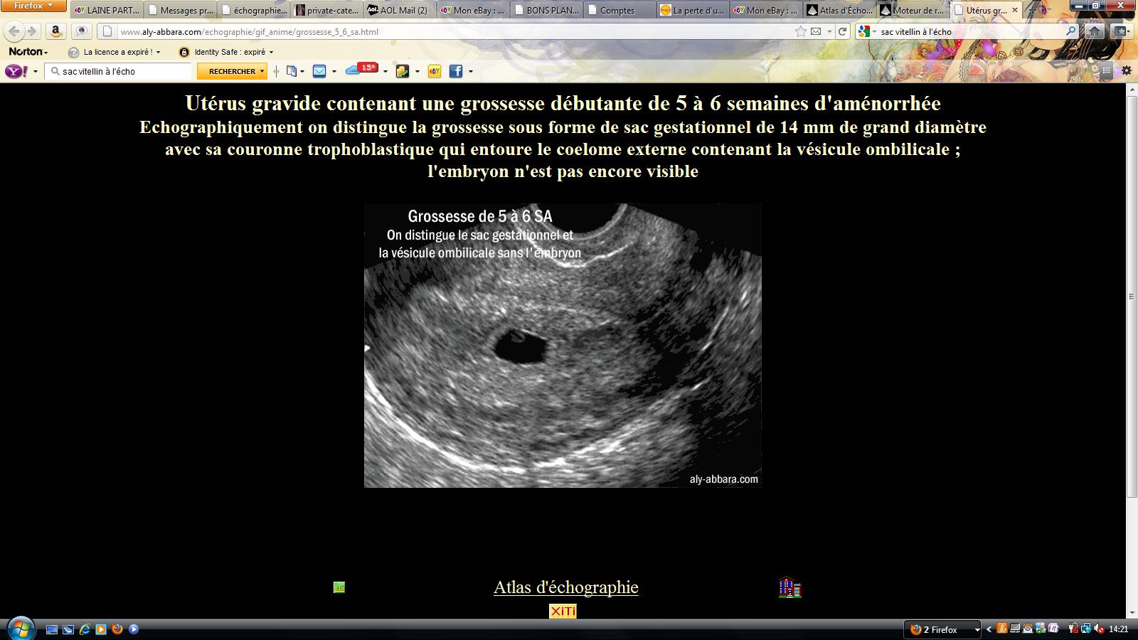 Suivi De Grossesse Echo Pour La Trimosie Effectue P2 Echographie Forum Grossesse Bebe