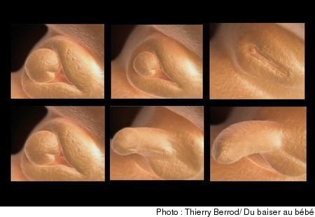 Comparaison Echographie Connaitre Le Sexe De Votre Bebe Forum Grossesse Amp Bebe Doctissimo Comparaison Echographie Connaitre Le Sexe De Votre Bebe Forum Grossesse Amp Bebe Doctissimo