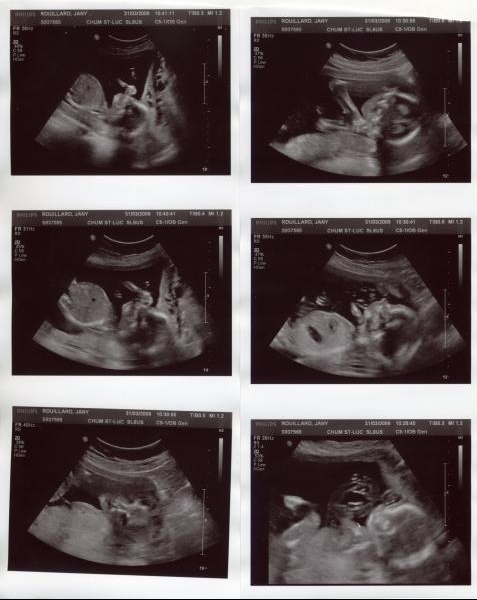 Pleins De Photos Echo sa Echographie Connaitre Le Sexe De Votre Bebe Forum Grossesse Amp Bebe Doctissimo Pleins De Photos Echo sa Echographie Connaitre Le Sexe De Votre Bebe Forum Grossesse Amp Bebe Doctissimo