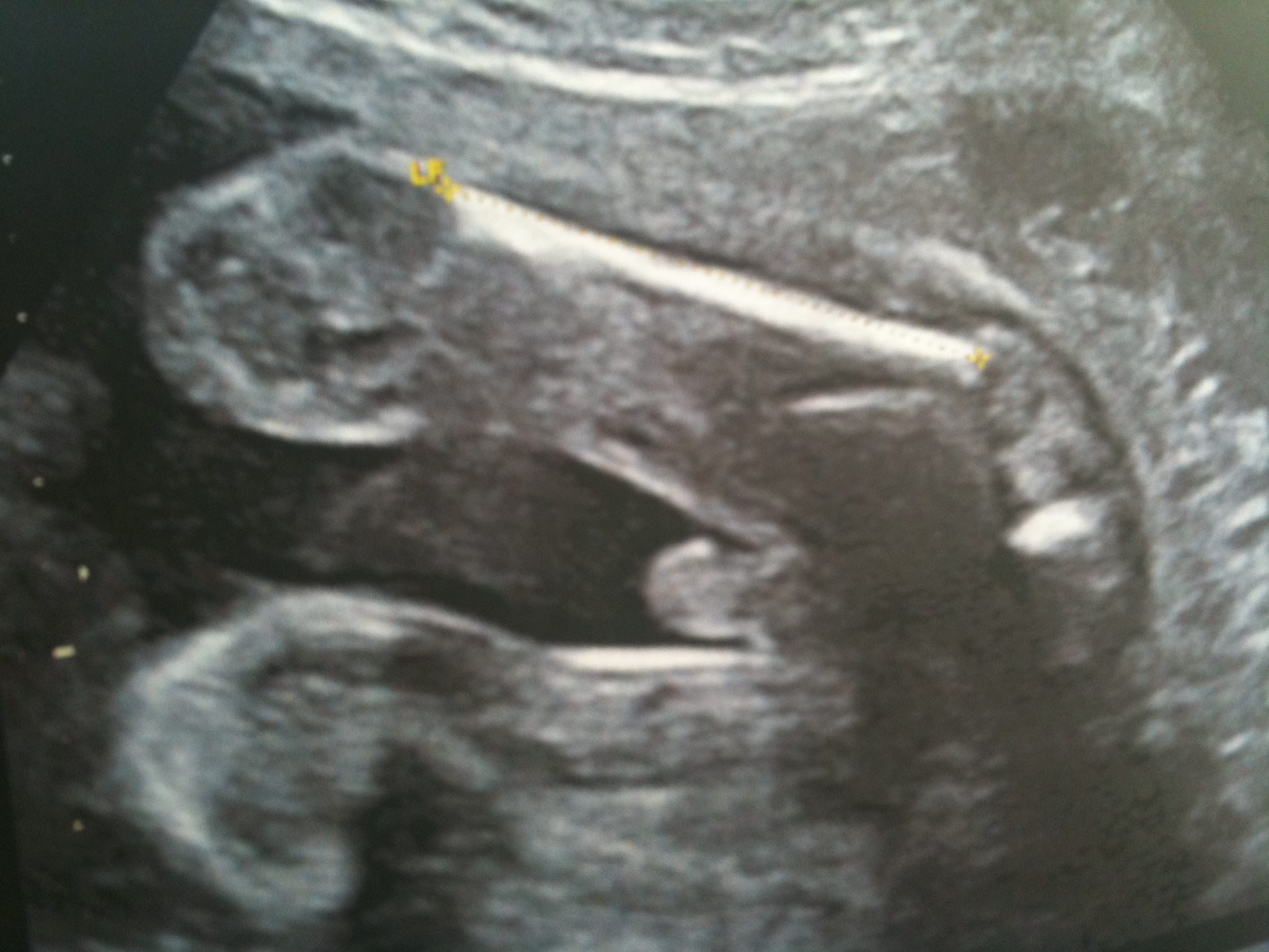 J Ai Honte Echographie Connaitre Le Sexe De Votre Bebe Forum Grossesse Amp Bebe Doctissimo J Ai Honte Echographie Connaitre Le Sexe De Votre Bebe Forum Grossesse Amp Bebe Doctissimo