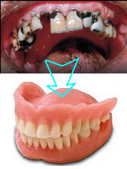 Notre Ado Ne Se Lave Plus Les Dents Problemes Dentaires Forum Sante Doctissimo