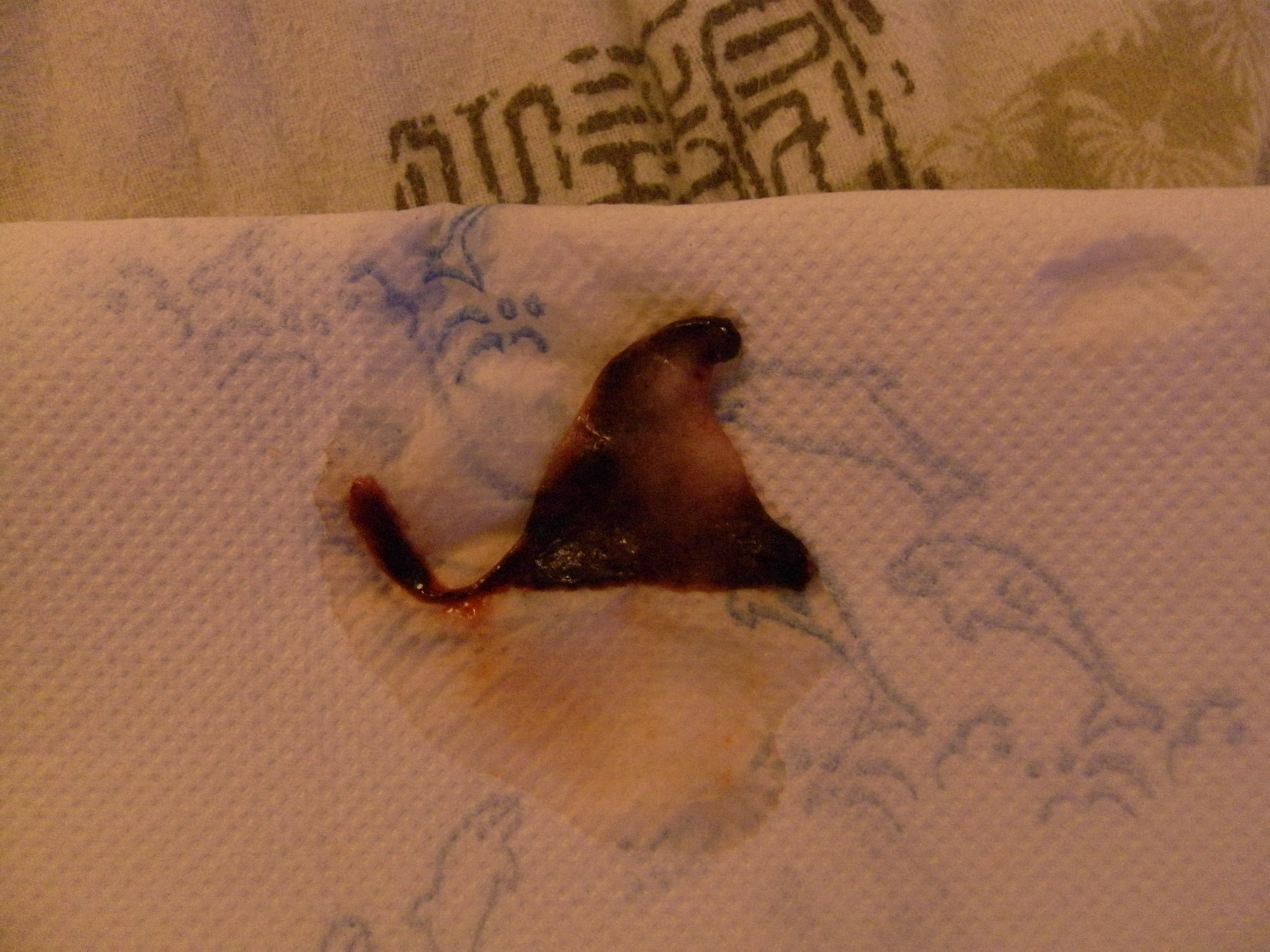 Help Grosse Perte Bizarre Fausse Couche Forum Grossesse Amp Bebe Doctissimo Help Grosse Perte Bizarre Fausse Couche Forum Grossesse Amp Bebe Doctissimo