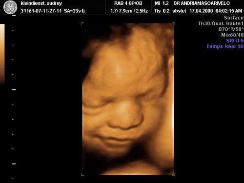 Eco A 32sg Et 2400kg Et Vous Futures Mamans Forum Grossesse Amp Bebe Doctissimo