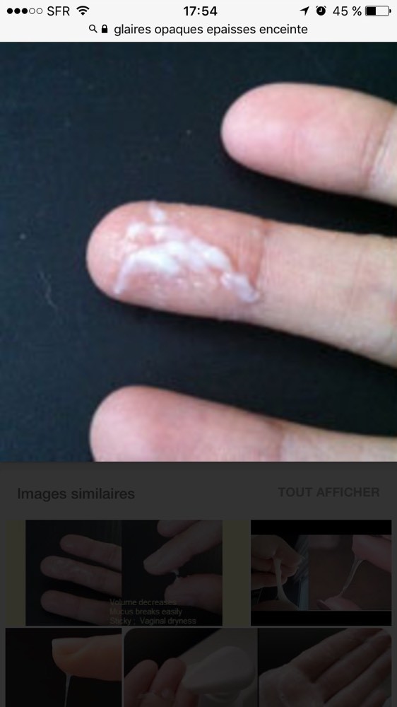 22sa Col A mm Prematures Forum Grossesse Amp Bebe Doctissimo 22sa Col A mm Prematures Forum Grossesse Amp Bebe Doctissimo