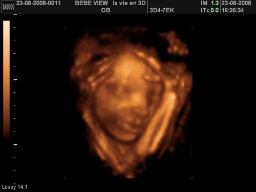 Post Pour Montrer Votre Echo 3d Echographie Connaitre Le Sexe De Votre Bebe Forum Grossesse Amp Bebe Doctissimo Post Pour Montrer Votre Echo 3d Echographie Connaitre Le Sexe De Votre Bebe Forum Grossesse Amp Bebe Doctissimo