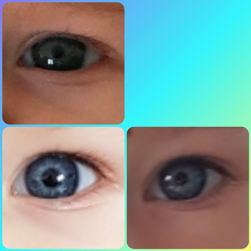 Avis Couleur Yeux Bebe 2 Mois Bebe Grandit Forum Grossesse Amp Bebe Doctissimo