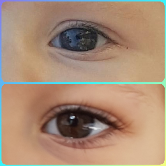 Avis Couleur Yeux Bebe 2 Mois