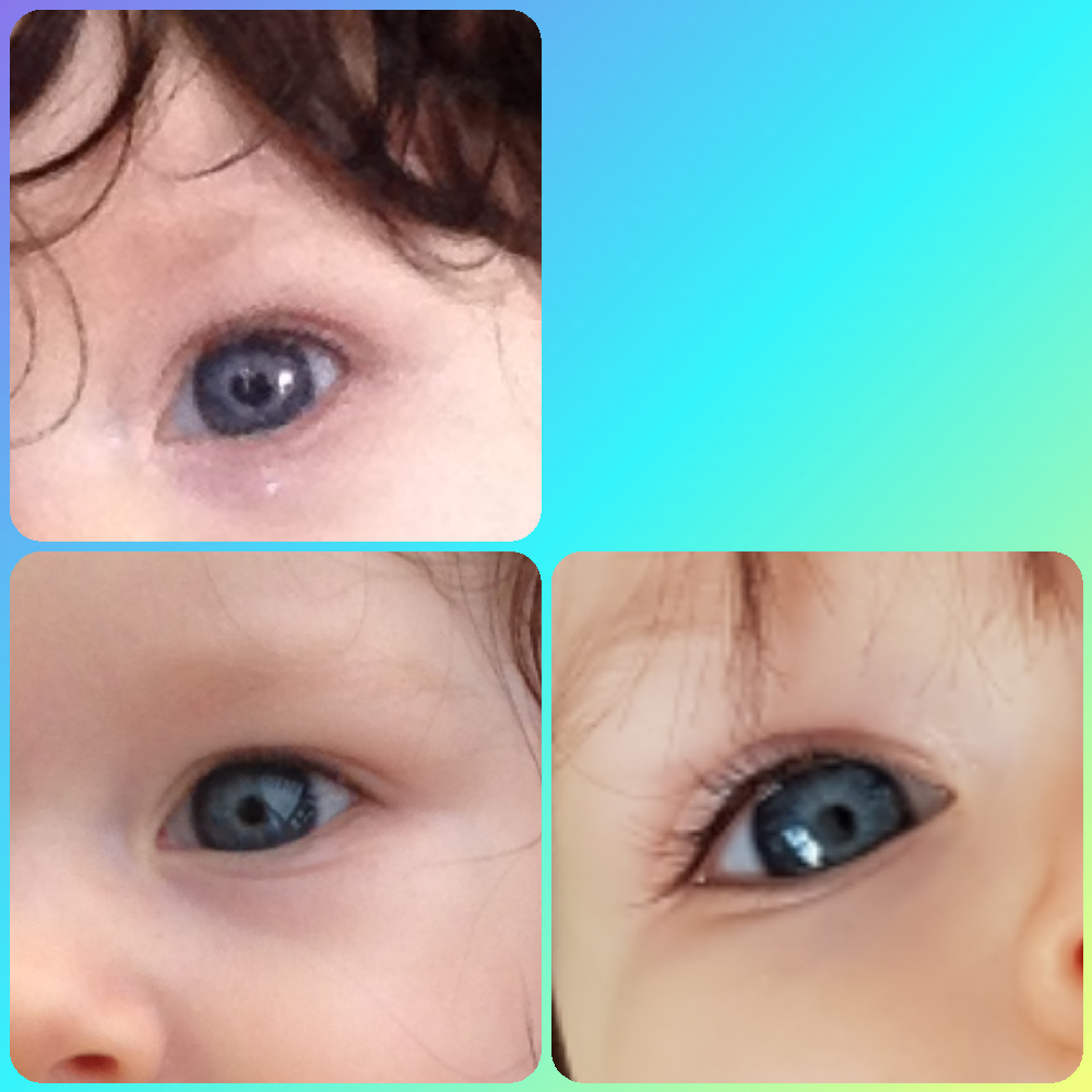 Avis Couleur Yeux Bebe 2 Mois Bebe Grandit Forum Grossesse Amp Bebe Doctissimo