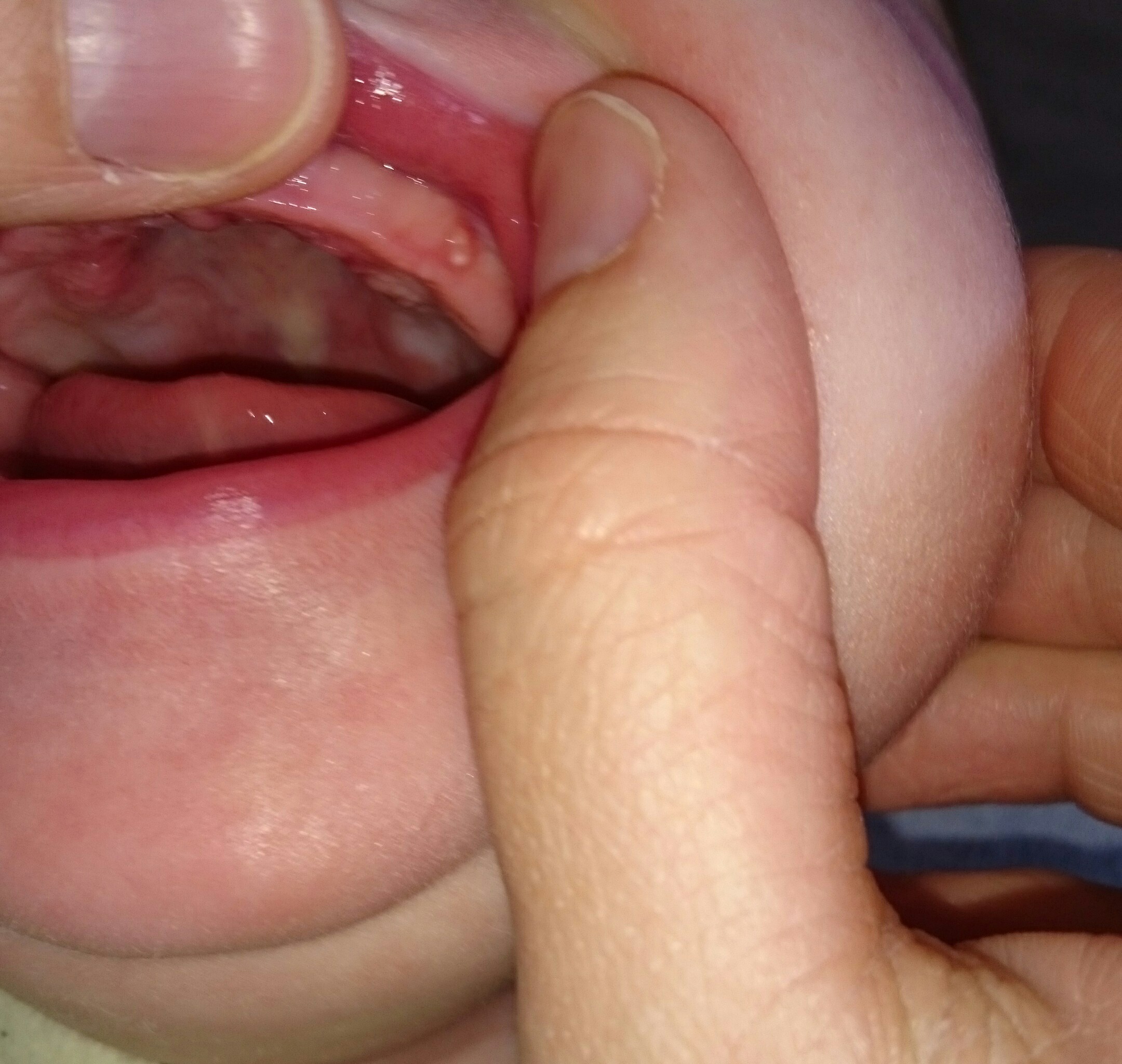 Help Ganglion Devant L Oreille Bebe Grandit Forum Grossesse Amp Bebe Doctissimo Help Ganglion Devant L Oreille Bebe Grandit Forum Grossesse Amp Bebe Doctissimo