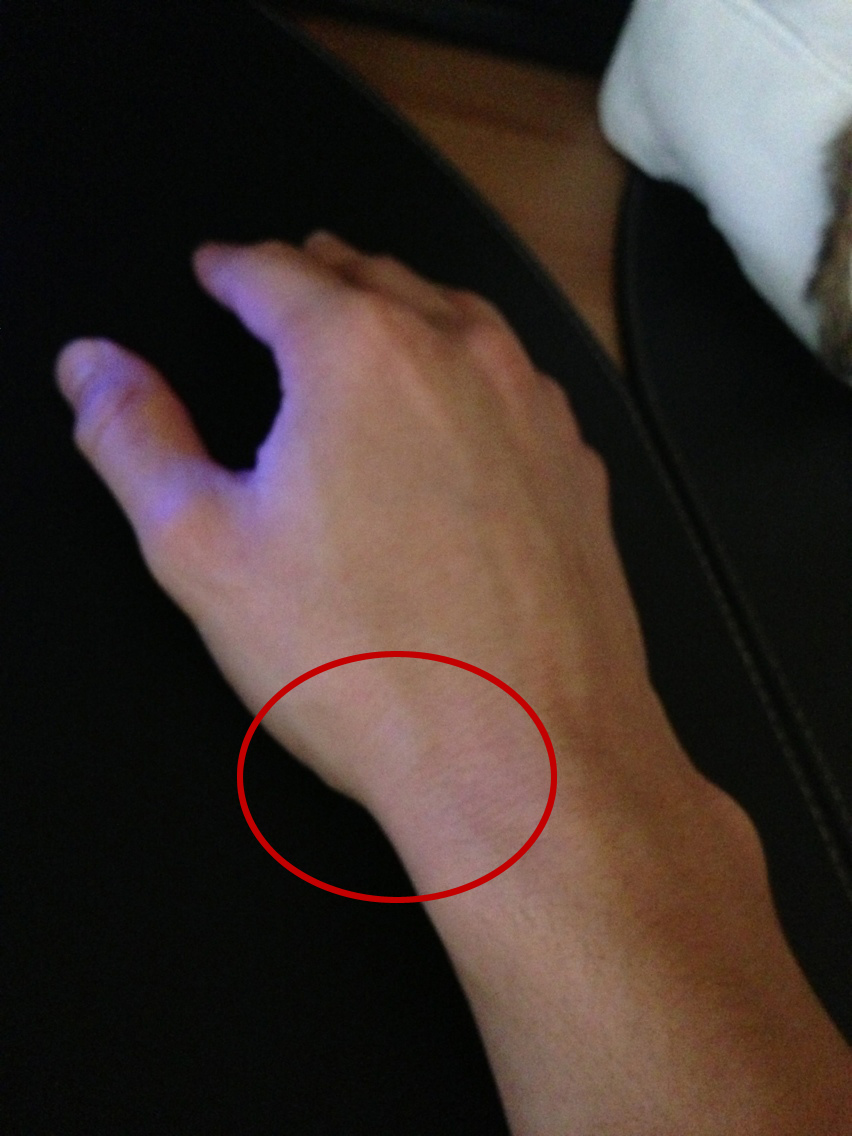 Mal aux poignets Clearance