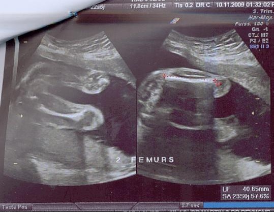 Echo 23 Sa A Quoi Pensez Vous Echographie Connaitre Le Sexe De Votre Bebe Forum Grossesse Amp Bebe Doctissimo Echo 23 Sa A Quoi Pensez Vous Echographie Connaitre Le Sexe De Votre Bebe Forum Grossesse Amp Bebe Doctissimo