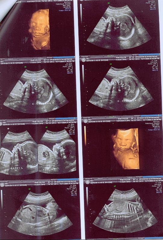 Echo 23 Sa A Quoi Pensez Vous Echo 23 Sa A Quoi Pensez Vous