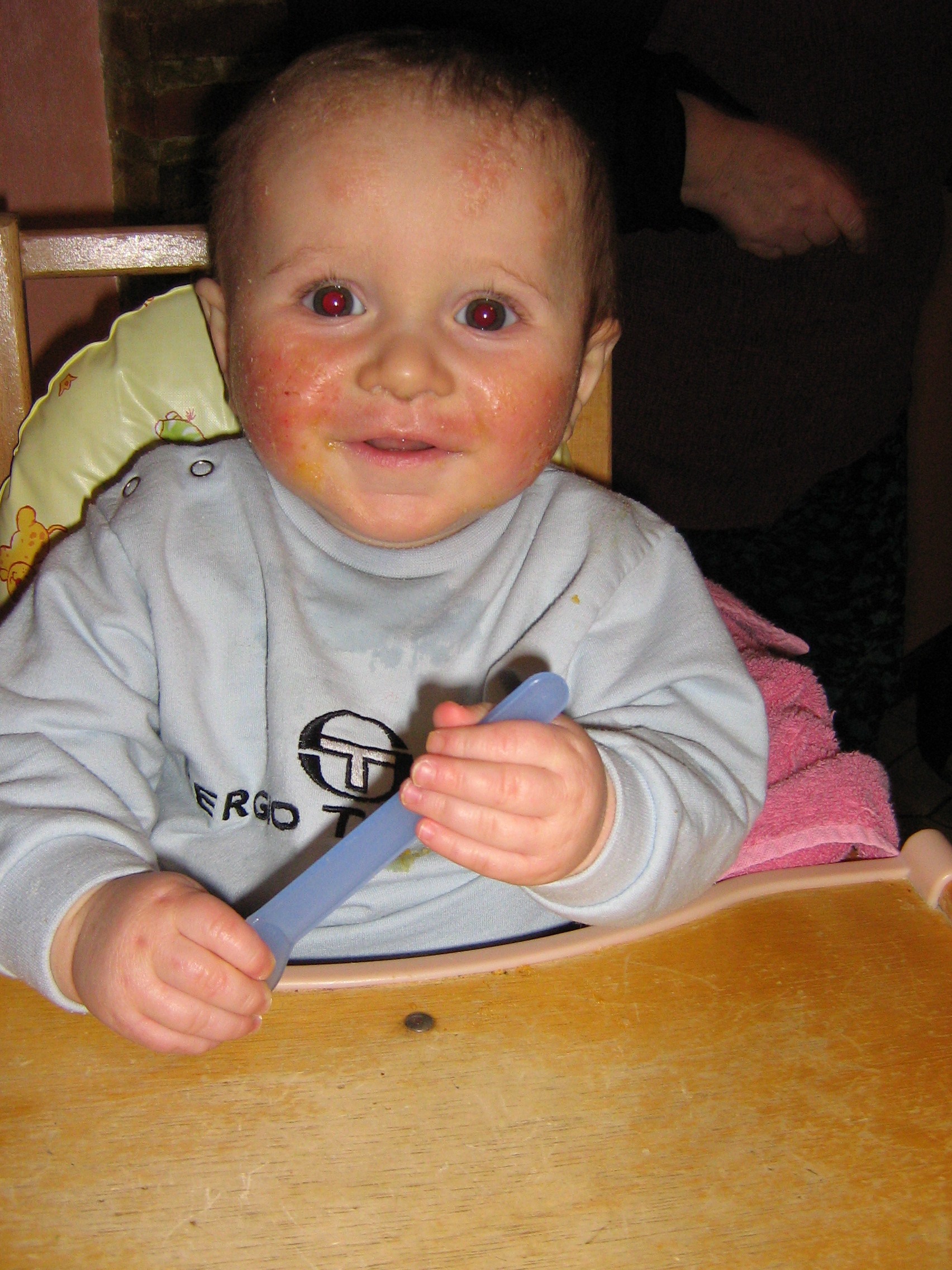 Eczema Atopique Et Allergie Plv Bebe De 6 Mois Allergies Et Eczema Forum Sante Doctissimo Eczema Atopique Et Allergie Plv Bebe De 6 Mois Allergies Et Eczema Forum Sante Doctissimo