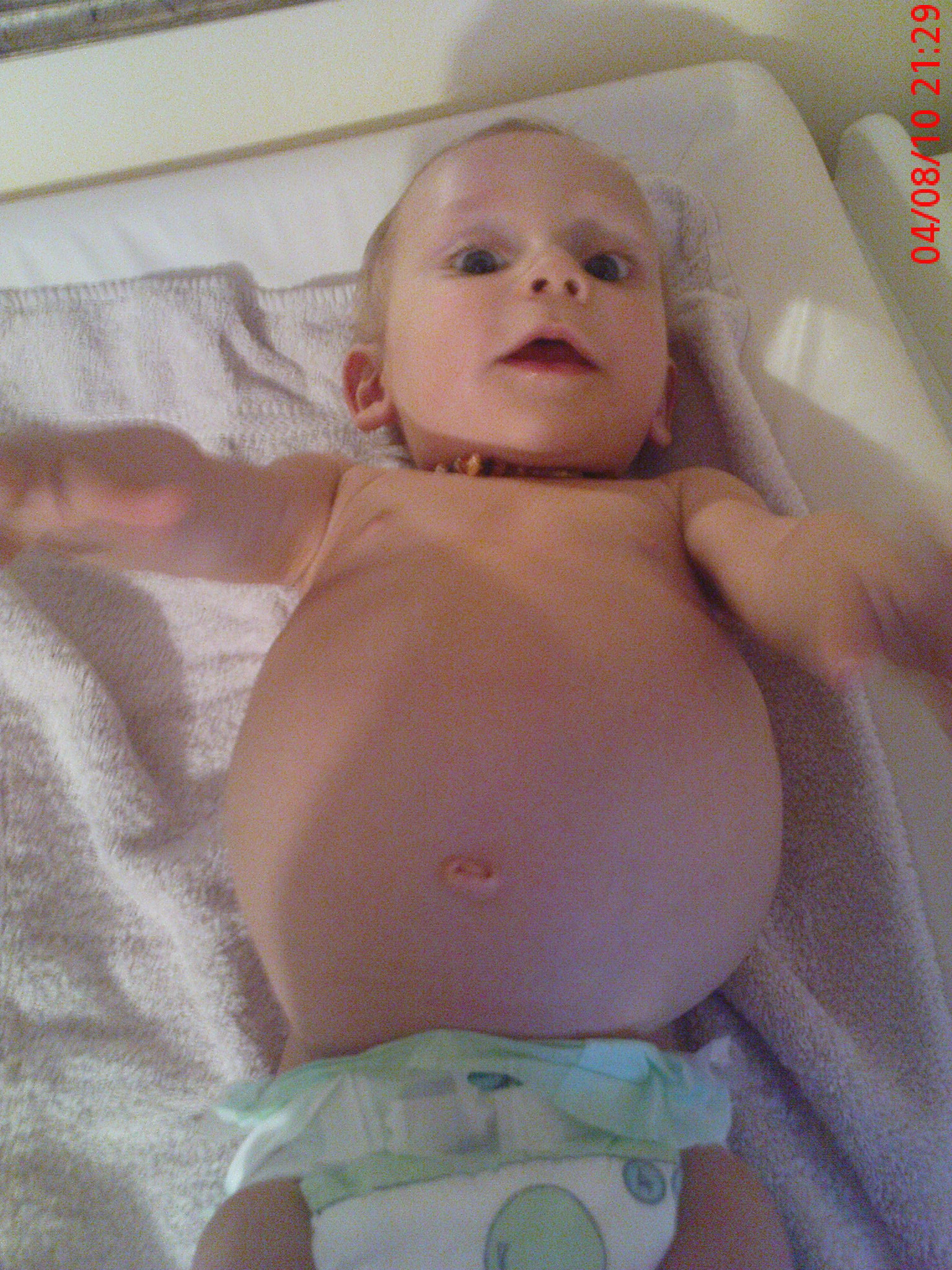 Quelqu Un A Des Nouvelles De Flo16 Perte De Poids Pour Evan Bebe Grandit Forum Grossesse Amp Bebe Doctissimo Quelqu Un A Des Nouvelles De Flo16 Perte De Poids Pour Evan Bebe Grandit Forum Grossesse Amp Bebe Doctissimo