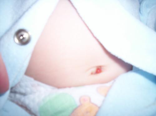 Cicatrice Nombril Consulter Ou Non Photo Mamans Et Futures Mamans Du Quebec Forum Grossesse Amp Bebe Doctissimo Cicatrice Nombril Consulter Ou Non Photo Mamans Et Futures Mamans Du Quebec Forum Grossesse Amp Bebe Doctissimo