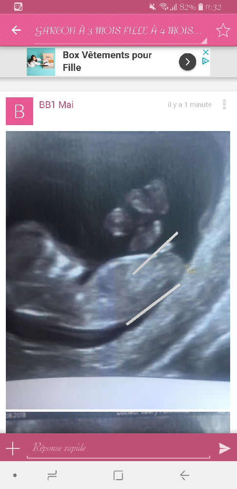 Garcon A 3 Mois Fille A 4 Mois Help Please Echographie Connaitre Le Sexe De Votre Bebe Forum Grossesse Amp Bebe Doctissimo Garcon A 3 Mois Fille A 4 Mois Help Please Echographie Connaitre Le Sexe De Votre Bebe Forum Grossesse Amp Bebe Doctissimo