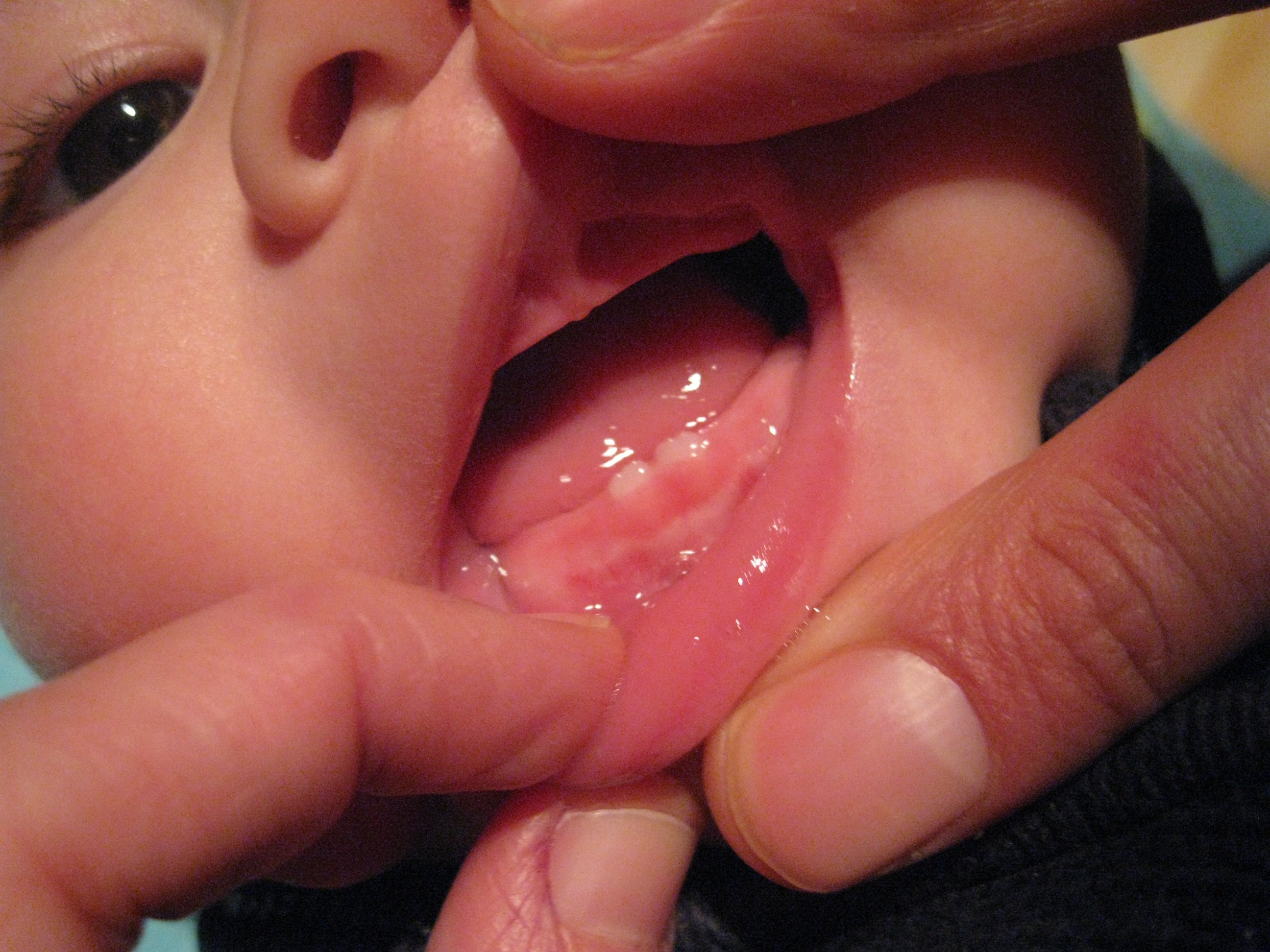 Combien De Temps Une Dent Met Elle Pour Percer La Gencive En Moyenne Bebe Grandit Forum Grossesse Amp Bebe Doctissimo Combien De Temps Une Dent Met Elle Pour Percer La Gencive En Moyenne Bebe Grandit Forum Grossesse Amp Bebe Doctissimo
