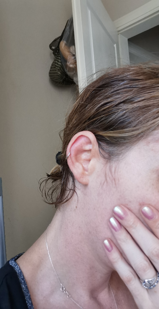Allergie ou infection piercing oreille ? - Tatouages et piercings ...