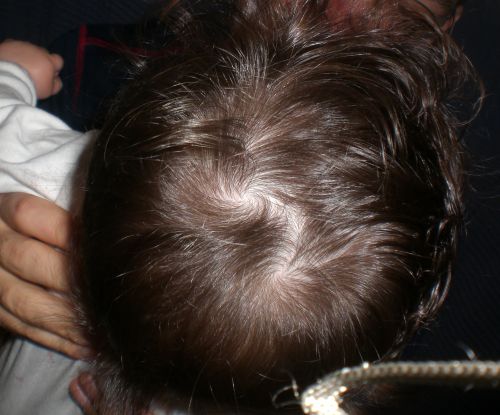 Deux Tourbillons De Cheveux Qui D Autre Bebe Grandit Forum Grossesse Amp Bebe Doctissimo