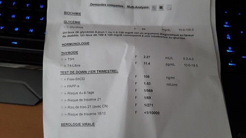 Clarte Nucale Bonne Mais Tres Mauvais Resultats Au Tri Test Amniocentese Forum Grossesse Amp Bebe Doctissimo