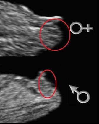 Echo A 13sa Vis Avis Sur Le Sexe Echographie Connaitre Le Sexe De Votre Bebe Forum Grossesse Amp Bebe Doctissimo Echo A 13sa Vis Avis Sur Le Sexe Echographie Connaitre Le Sexe De Votre Bebe Forum Grossesse Amp Bebe Doctissimo