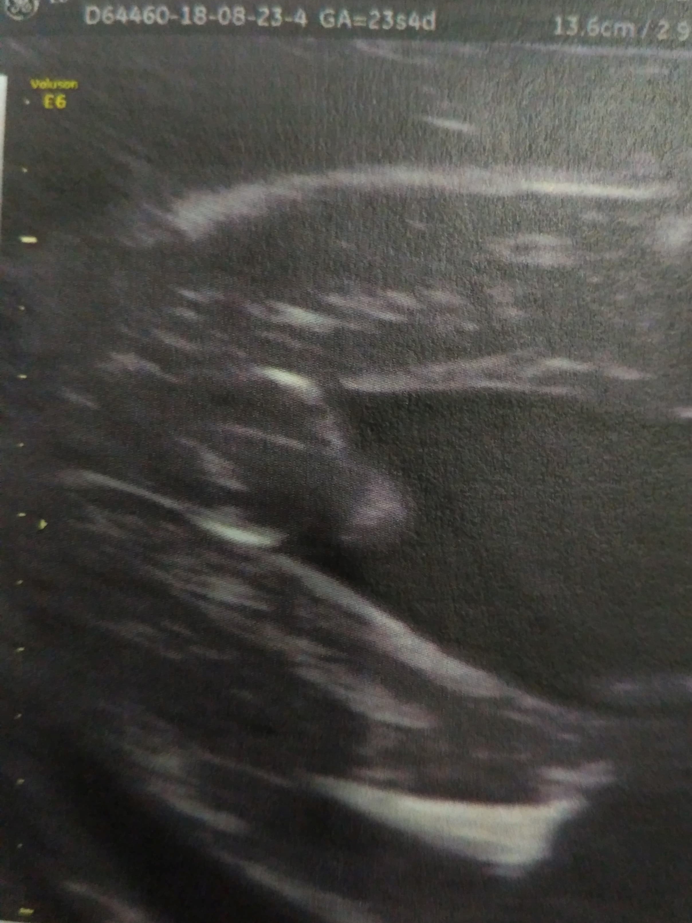 23sa 4 A Votre Avis Fille Ou Garcon Echographie Connaitre Le Sexe De Votre Bebe Forum Grossesse Amp Bebe Doctissimo 23sa 4 A Votre Avis Fille Ou Garcon Echographie Connaitre Le Sexe De Votre Bebe Forum Grossesse Amp Bebe Doctissimo