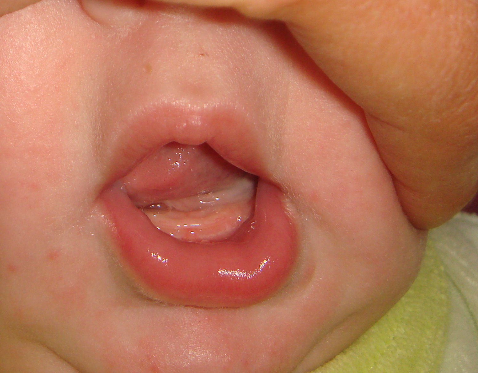 Help Les Dents Ou Pas Bebe Grandit Forum Grossesse Amp Bebe Doctissimo Help Les Dents Ou Pas Bebe Grandit Forum Grossesse Amp Bebe Doctissimo