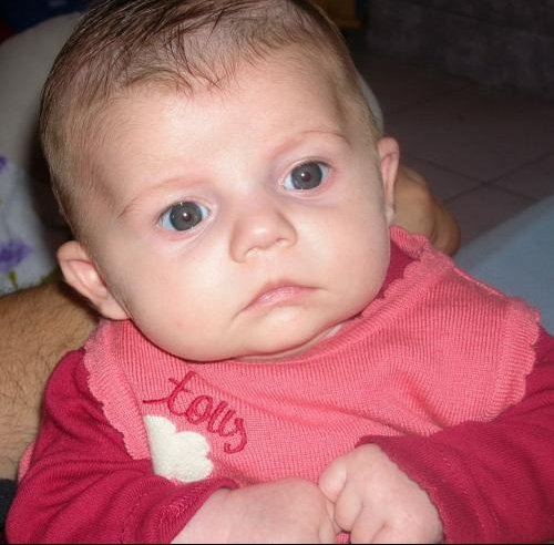 Oreilles Decollees Developpement De L Enfant Forum Grossesse Amp Bebe Doctissimo Oreilles Decollees Developpement De L Enfant Forum Grossesse Amp Bebe Doctissimo